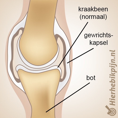 artrose anatomie gezond