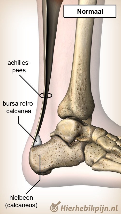 enkel achillespees bursa retrocalcanea hielbeen calcaneus