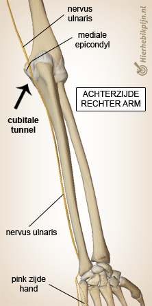 arm cubitale tunnel nervus ulnaris