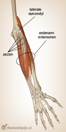 arm extensoren