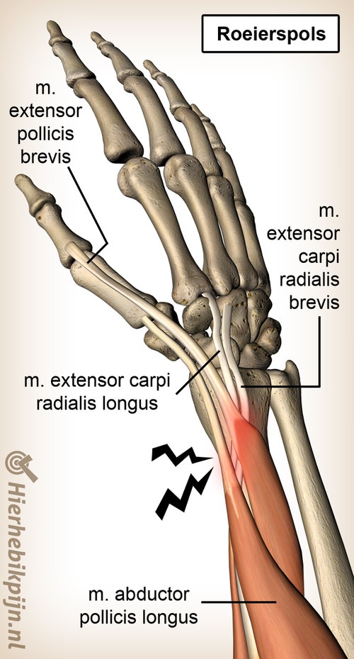 arm roeierspols anatomie extensor carpi radialis brevis longus abductor pollicis