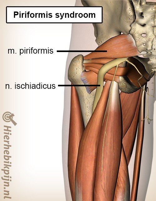 bil piriformis syndroom anatomie