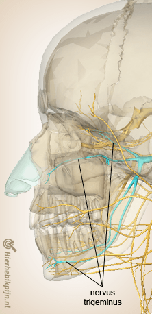 hoofd cervicogene hoofdpijn cgh nervus trigeminus