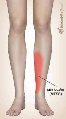 mtts pijnlocatie