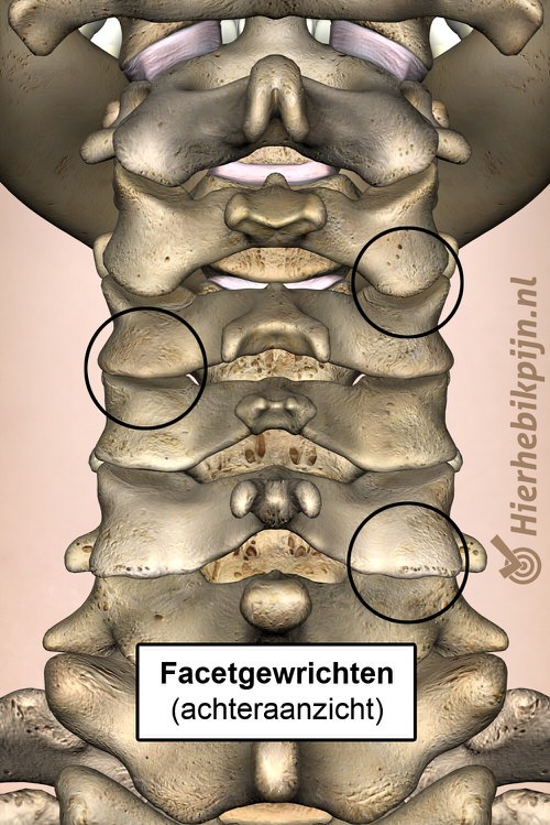 nek facetgewrichten achter aanzicht cervicaal