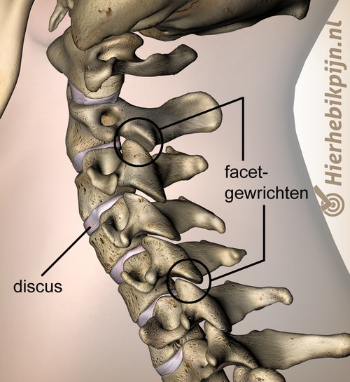 nek facetgewrichten zijaanzicht lateraal discus