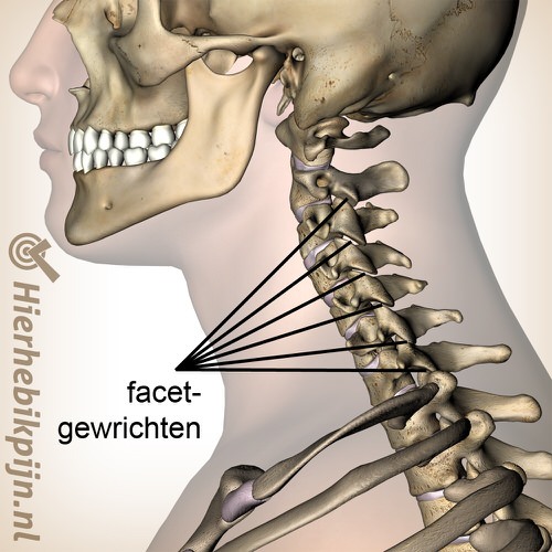 nek facetgewrichten zijaanzicht lateraal