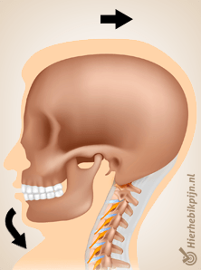 nek whiplash pijn beweging 1