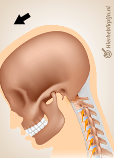 nek whiplash pijn beweging 2
