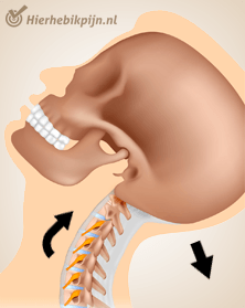 nek whiplash pijn beweging 3