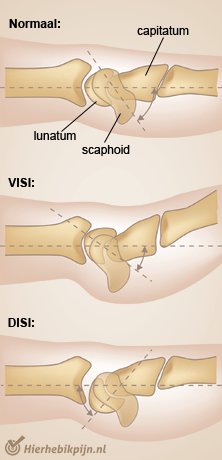 pols VISI DISI