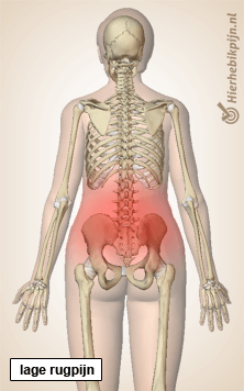rug lage rugpijn wervelkolom skelet