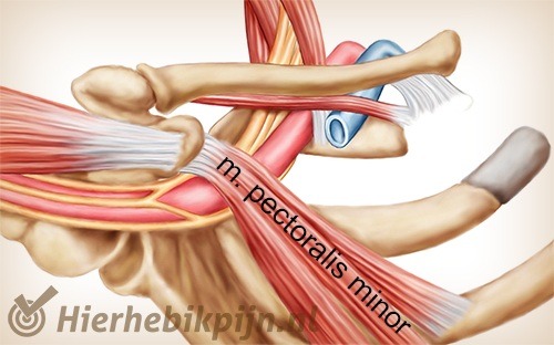 schouder arm hand tos thoracic outlet syndroom pectoralis minor