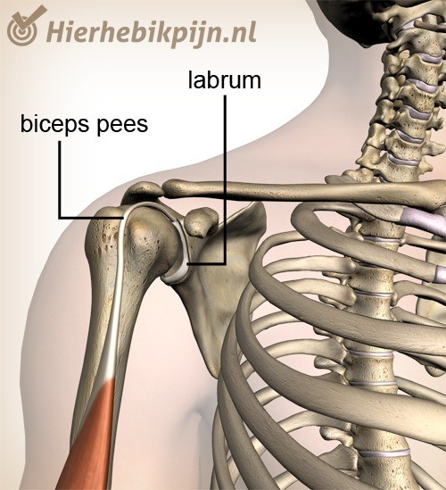 schouder labrum biceps