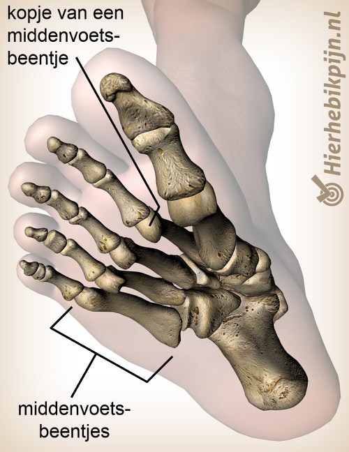 voet metatarsi kopje metatarsus anatomie onderaanzicht