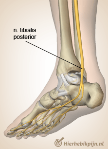 voet nervus tibialis posterior