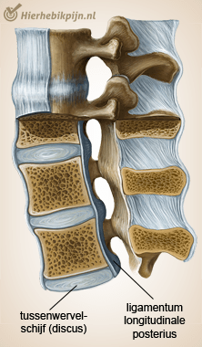 wervelkolom ligamentum longitudinale posterius tussenwervelschijf discus