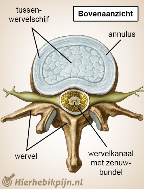 wervelkolom wervel bovenaanzicht tussenwervelschijf zenuwen