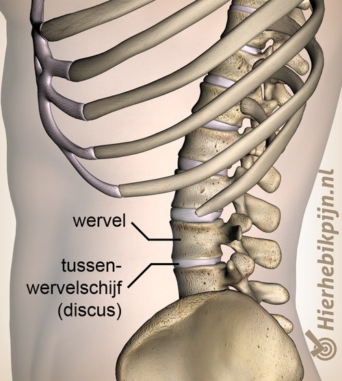 Y-Strap behandeling, Klachten wervelkolom