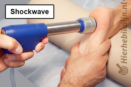 voet shockwave therapie