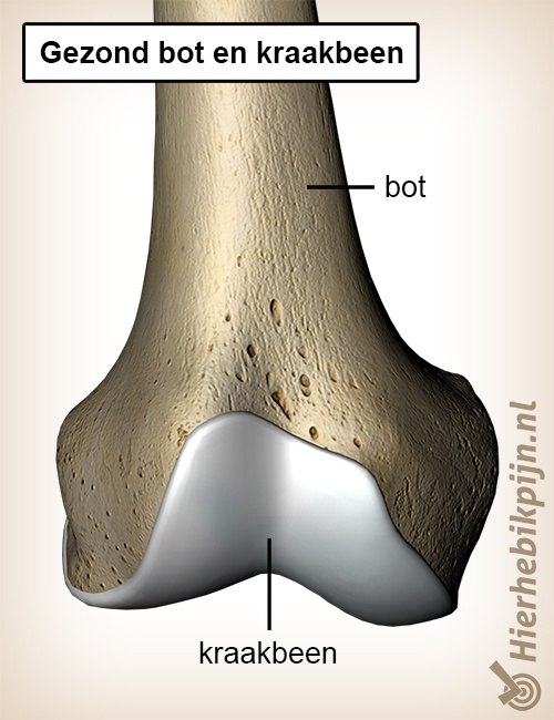 kraakbeen-gezond-bot-anatomie-cartilago.jpg