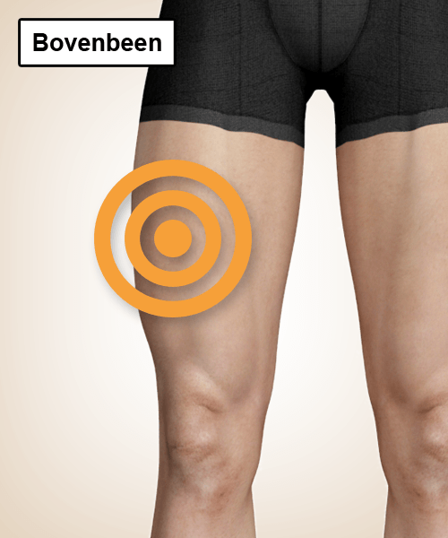 pijnlocatie-bovenbeen.png