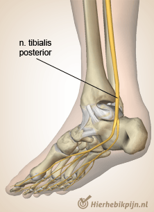 voet-nervus-tibialis-posterior.png