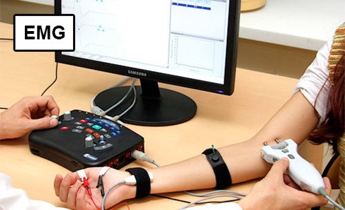 Arm emg 2