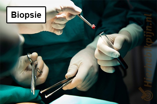 Biopsie
