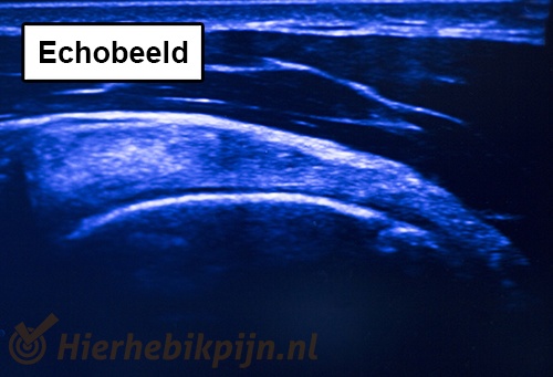 Echobeeld