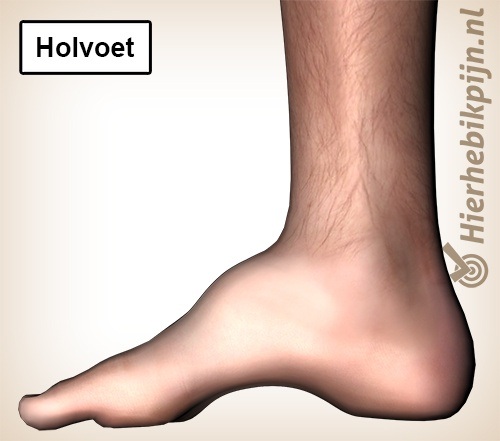 Holvoet mediaal binnenkant pes cavus