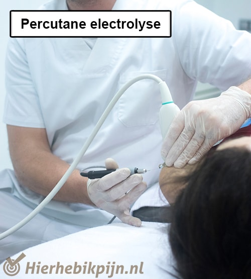 Percutane elektrolyse pe epte pne usget